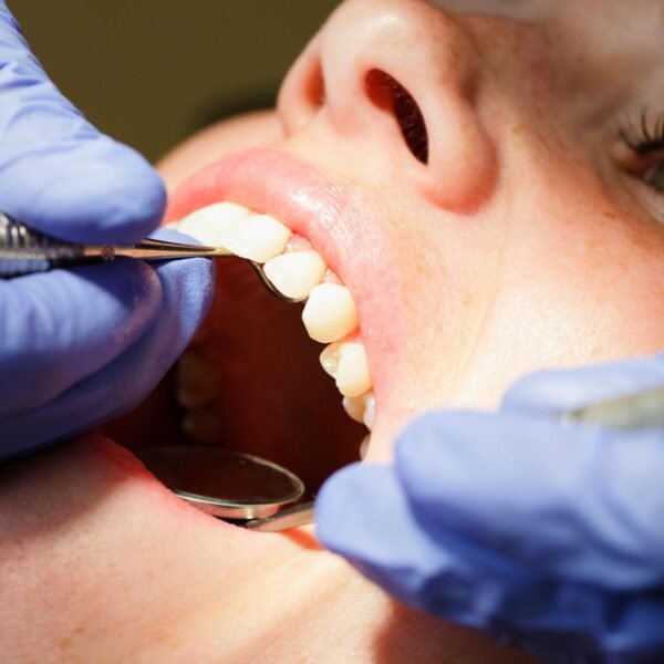 oral 10